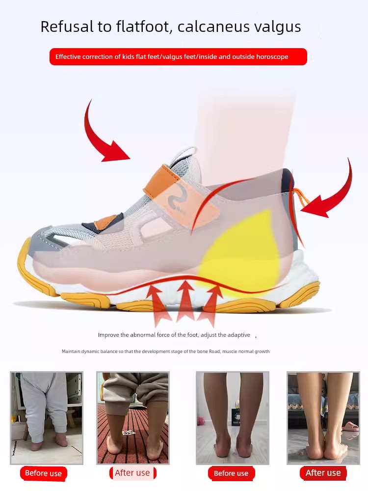 Kids Flat Foot Correction Sandals Inner and Outer Eight Characters Correction Coolname Sneaker Baby Foot Valgus Tiptoe Arch Supporter — 2