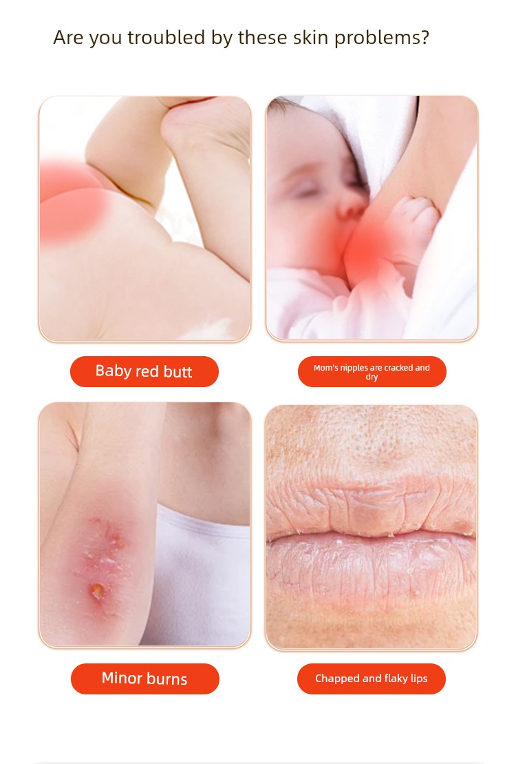 Tongrentang Level Special Egg Butter Baby Nipple Chapped Breastfeeding Egg Oil Baby Red Butt Diaper Rash Ointment — 2