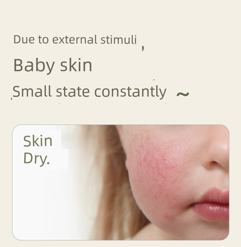 Plant-Based Children's Moisturizing Cream for Autumn and Winter, Nourishing Infant Face Cream, Baby Cream, Body Lotion, Official Authentic Product — 5