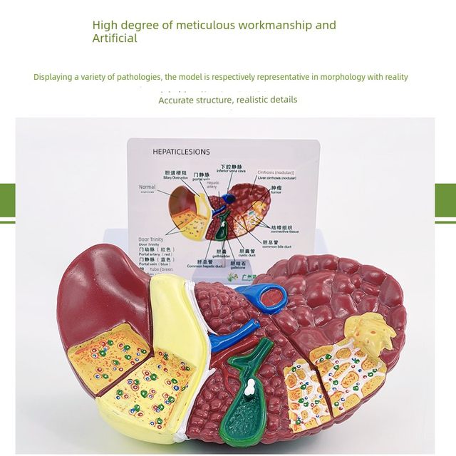 Highly simulated liver model liver anatomical model liver bile pancreas spleen duodenal relief lesions liver bile pancreas model