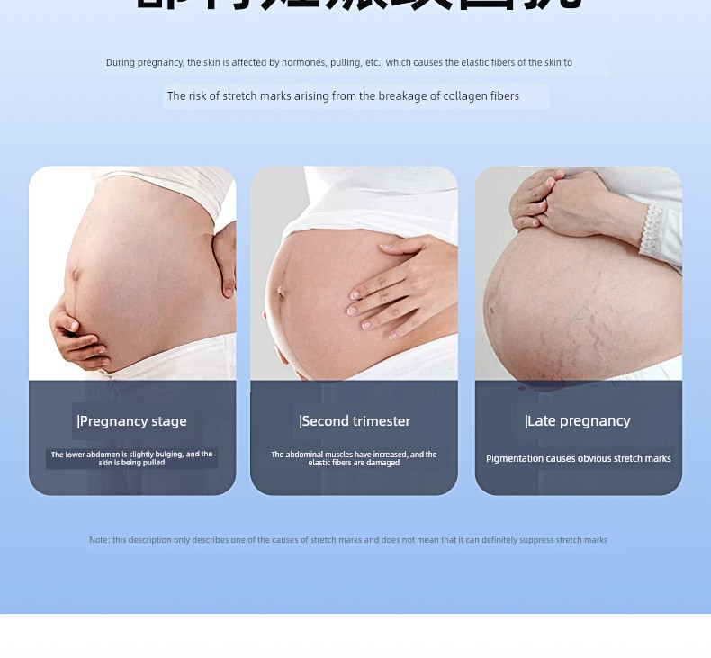 Hoghoag Belly Belt for Pregnant Women in the Second Trimester of Pregnancy Handy Gadget Detachable Belly Belt — 9