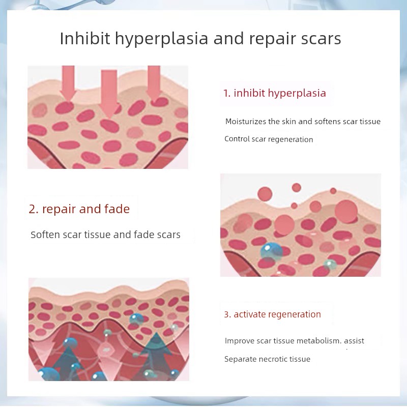 Scar Removal Cream for Old Scars, Burn Scars, Keloids, Raised Scars, Surgical Scars, and Facial Hyperplasia