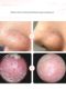 V.ONE wrist-sucking blackhead instrument face cleaning pore visualization electric artifact acne removal suction device