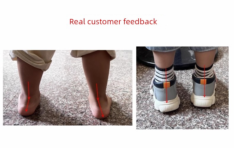 Kids Flat Foot Correction Sandals Inner and Outer Eight Characters Correction Coolname Sneaker Baby Foot Valgus Tiptoe Arch Supporter — 2