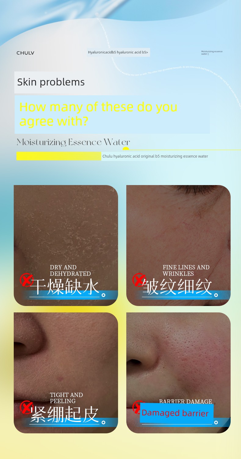 Hyaluronic Acid Original B5 Moisturizing Essence Water Long-Lasting Moisturizing, Firming, Anti-Wrinkle, Soothing, Repairing and Nourishing Official — 3