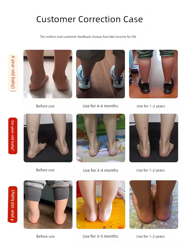 Kids Flat Foot Correction Sandals Inner and Outer Eight Characters Correction Coolname Sneaker Baby Foot Valgus Tiptoe Arch Supporter — 3