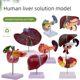 Highly simulated liver model liver anatomical model liver bile pancreas spleen duodenal relief lesions liver bile pancreas model