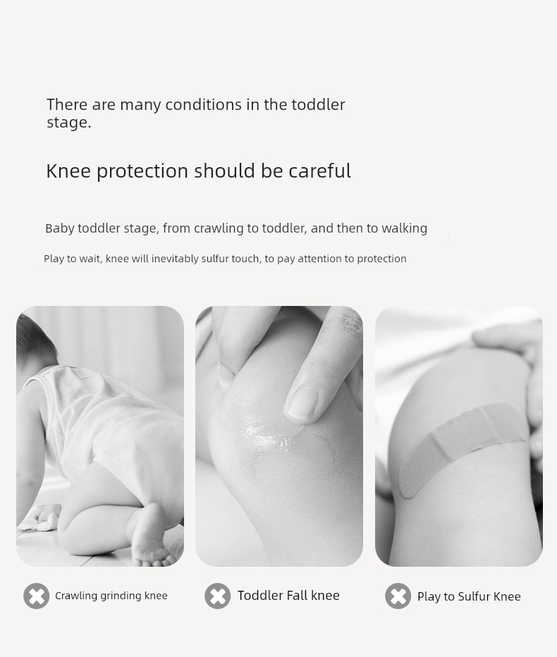 Baby Knee Pads for Crawling, Baby Knee Protectors, Children's Crawling Anti-Fall Elbow Pads, Summer Thin Breathable Style — 2