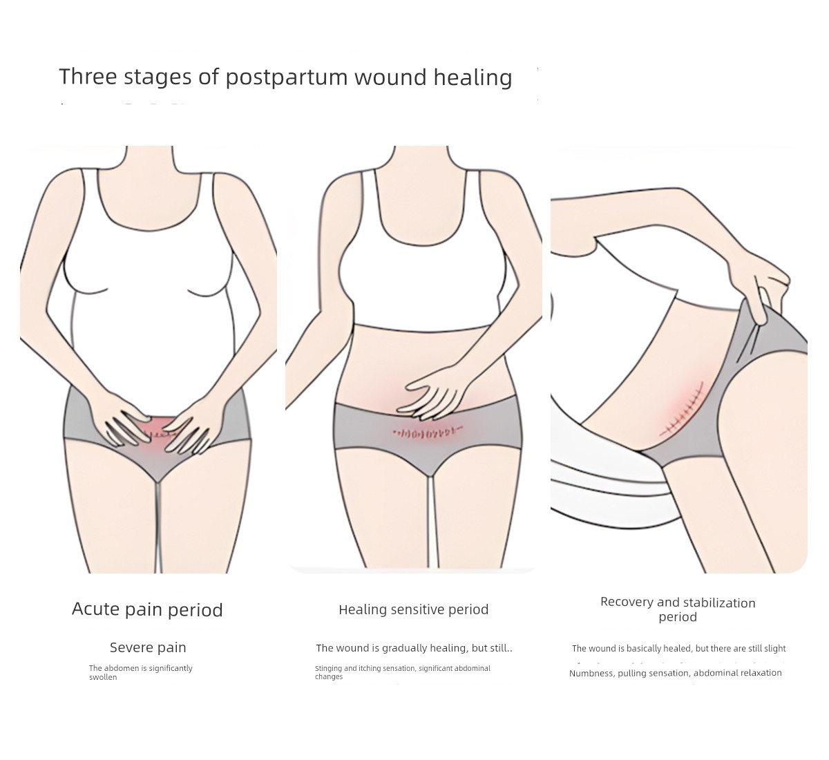 Jq Jingqi Postpartum High-Waisted Cotton Panties, Non-Abrasive, Extended Crotch, Tummy Control, Specially Designed for Cesarean Section during the — 5