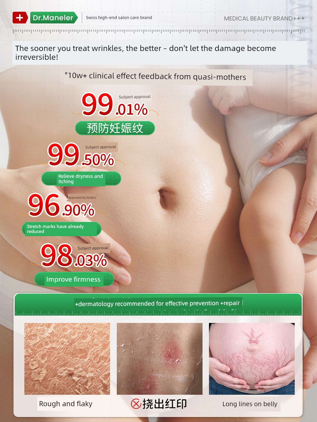 Swiss Pregnancy Oil for Expectant Mothers, Olive Oil for Moisturizing, Relieving Itching, and Preventing Stretch Marks during Pregnancy, Firming Belly — 2