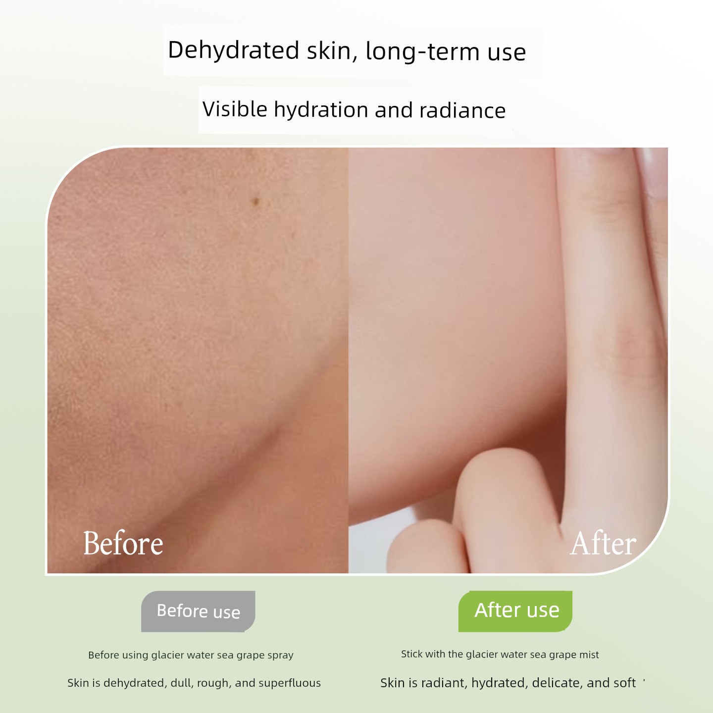 Botanism Moisturizing Spray for Wet Compressing Pregnant Women — 3