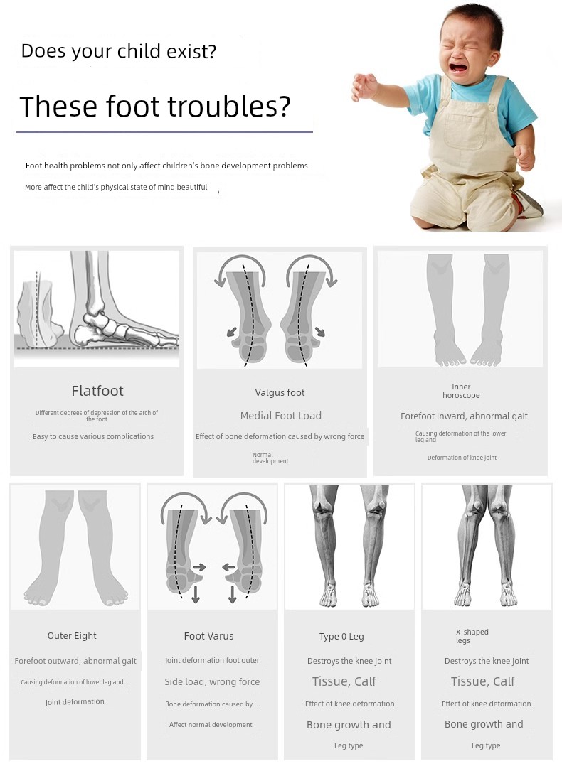 Kids Flat Foot Correction Sandals Inner and Outer Eight Characters Correction Coolname Sneaker Baby Foot Valgus Tiptoe Arch Supporter — 5