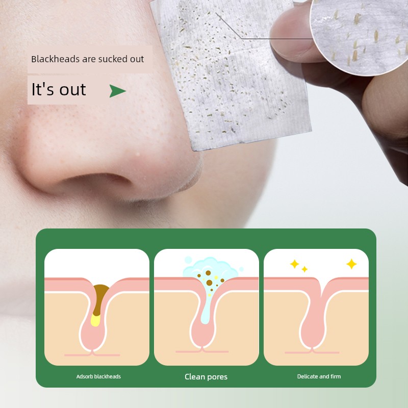Hanji Tea Tree Blackhead Removal Kit Official Genuine Product for Pore Tightening and Deep Cleansing, Professional Salon Grade Xza68 — 2