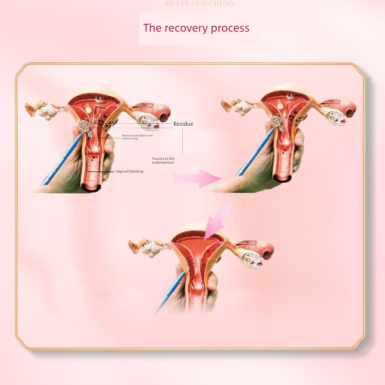 Postpartum Recovery Supplements, Post-Abortion Recovery Supplements, Postpartum Water, Uterine Lochia Nutritional Supplements, Repair and Care for Recovery — 3