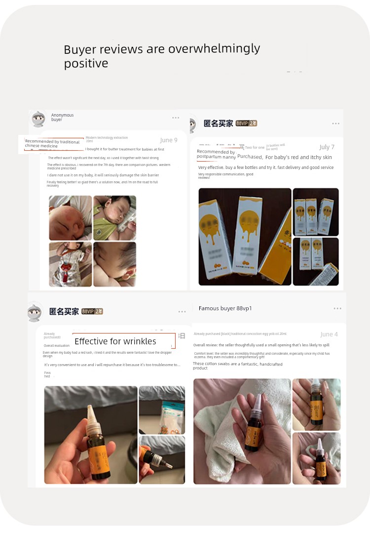 Tongrentang Level Special Egg Butter Baby Nipple Chapped Breastfeeding Egg Oil Baby Red Butt Diaper Rash Ointment — 8