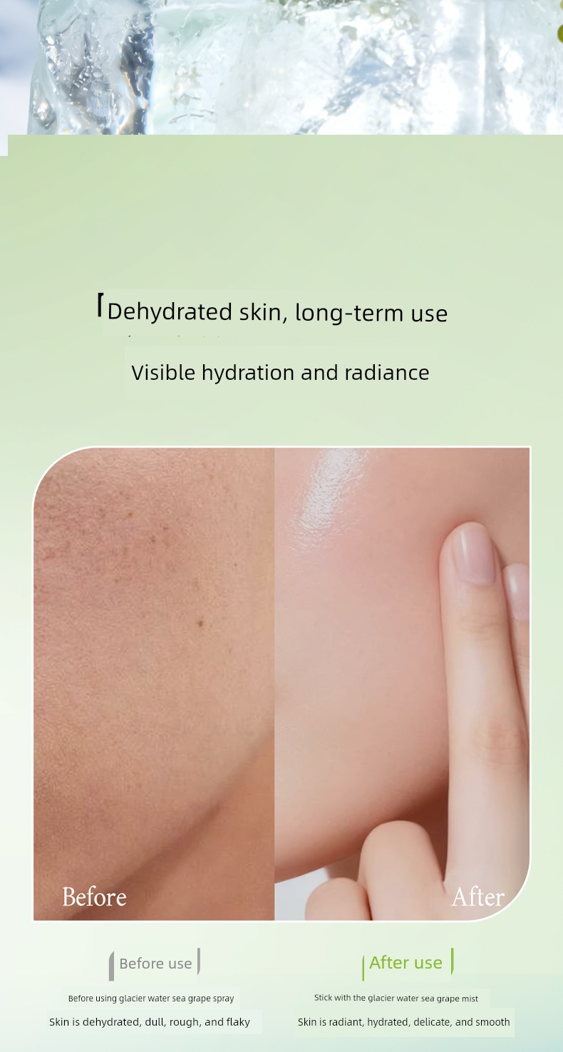 Botanism Moisturizing Spray for Wet Compressing Pregnant Women — 6