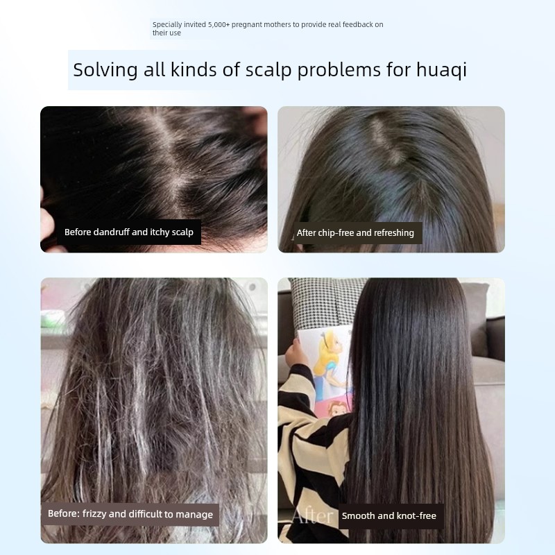 Special Anti-Dandruff and Oil-Control Shampoo for Pregnant Women, Can Be Used as a Shower Gel and Conditioner Set, Hair Washing Cream — 5