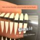Double eyelid patch for women with double-sided invisible and traceless natural super sticky olive-shaped beautiful eye artifact swollen eyelids special for single eyelids