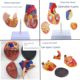 Genuine 1 1 human heart anatomical model B-ultrasound color ultrasound heart model disassembly medical natural big heart teaching