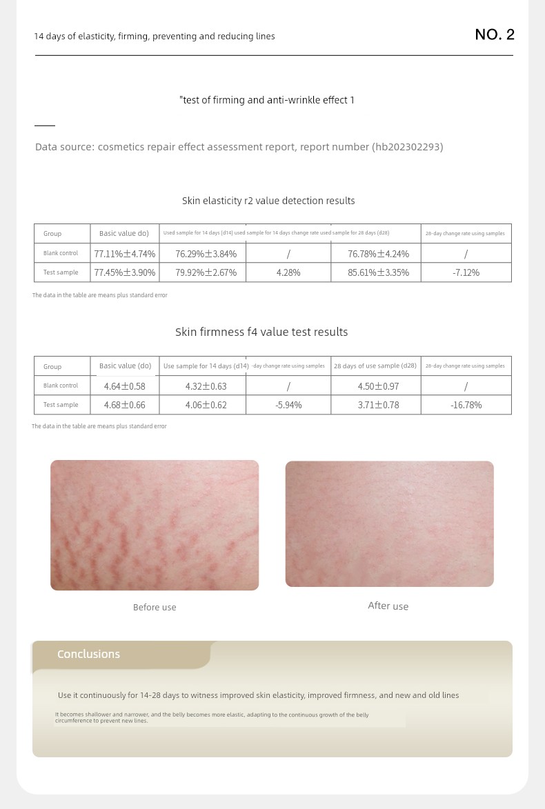 German Nenfu Olive Pregnancy Oil for Women Preparing for Pregnancy to Prevent and Reduce Obesity Marks, Using Skin-Rejuvenating Pregnancy Body Essence Oil — 34