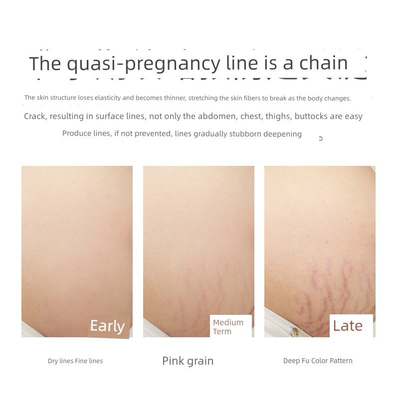 Australian Lauder Special Prevention Fade Lines Pregnancy Oil — 4