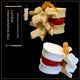 Medical human lumbar disc TU demonstration model Lumbar D lesion model Spine spine model Free shipping
