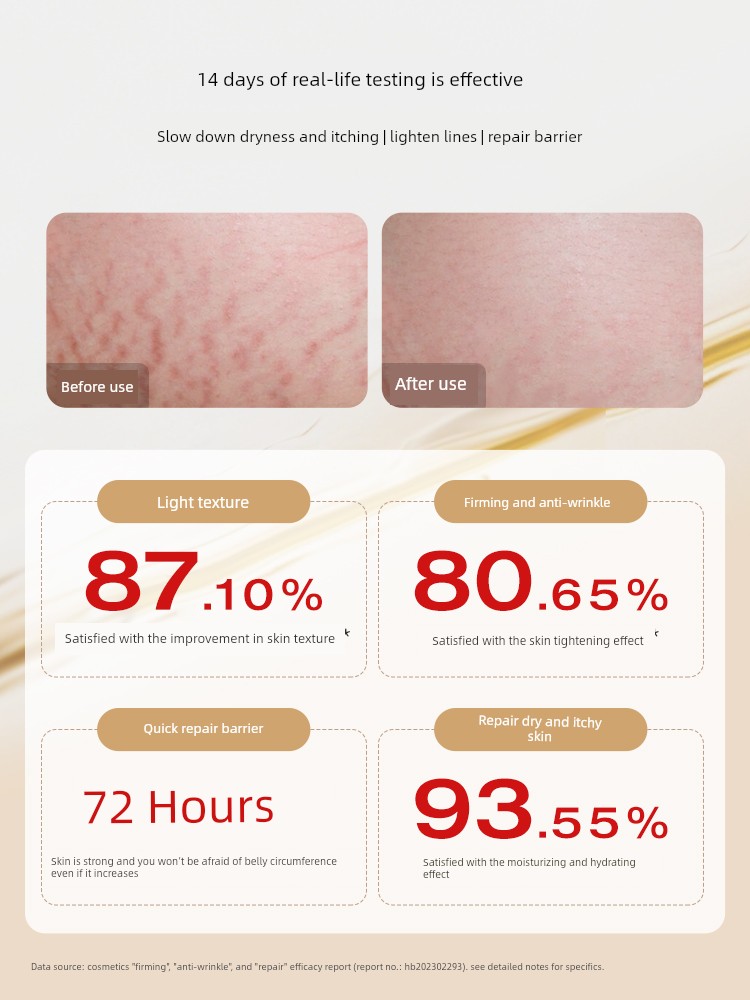 German Nenfu Olive Pregnancy Oil for Women Preparing for Pregnancy to Prevent and Reduce Obesity Marks, Using Skin-Rejuvenating Pregnancy Body Essence Oil — 2